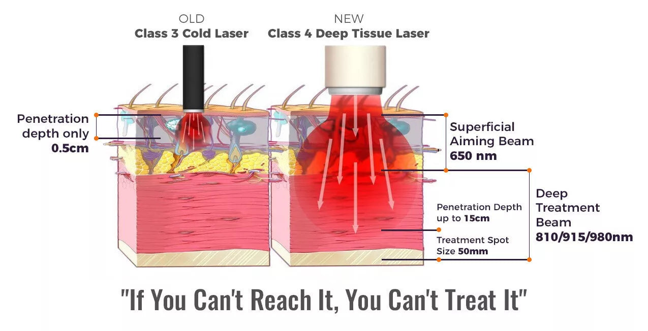 Class IV Laser 30W Therapy Device